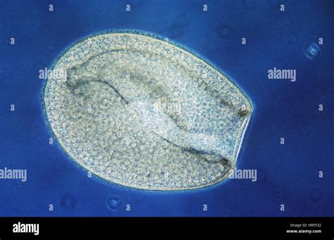  Bursaria Truncatella: An Undulating Microscopic Marvel Exhibiting Astonishingly Complex Feeding Habits!