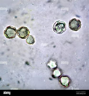  Acanthamoeba: Loài động vật đơn bào có hình dạng biến đổi kỳ lạ, một kẻ săn mồi vô cùng hiệu quả!