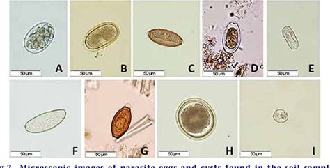  Isospora! Unveiling the Microscopic World of This Parasitic Protagonist