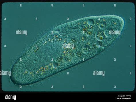  Paramecium: Một sinh vật đơn bào với vẻ đẹp kỳ lạ và khả năng tự vệ độc đáo!