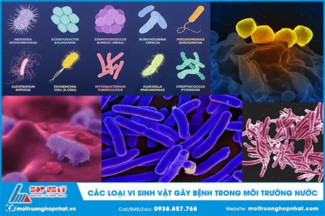  Pearlworm: Con ốc có vỏ hình nón sống trong môi trường nước lợ và là một loài động vật thân mềm đáng chú ý!