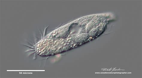  Tétrahymena! Unraveling the Mysteries of This Tiny Ciliate Marvel