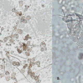  Zoothamnium: Một Vị Hoàng đế Siêu Vi Microscopic Có Khả Năng Kiểm Soát Cả Nước Thế Giới Vô Hình!